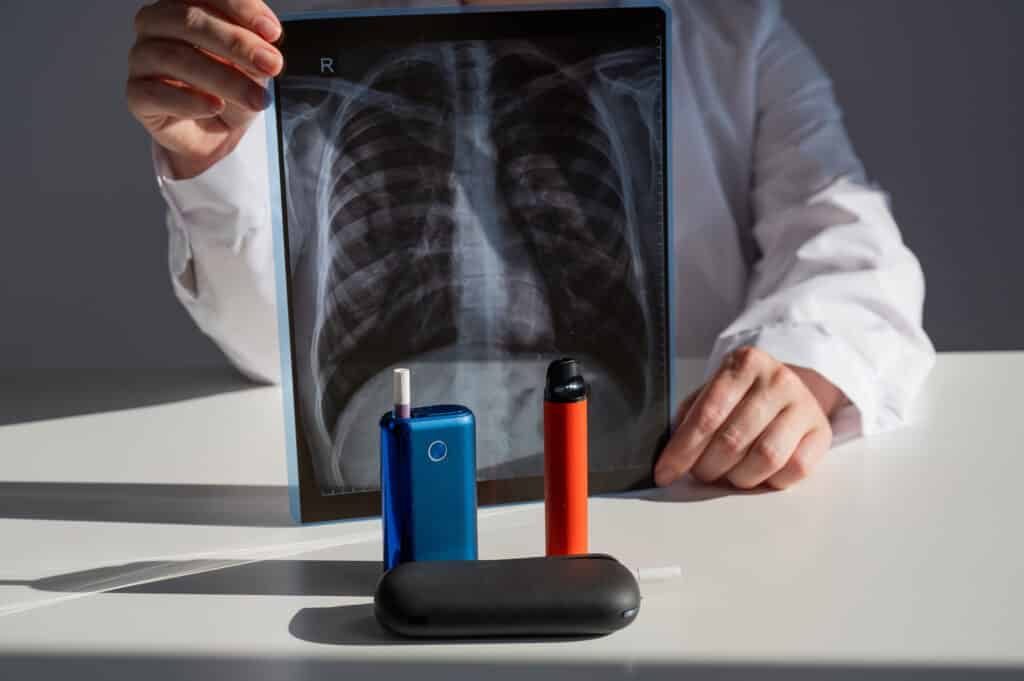 Le vapotage pourrait entraîner des signes précoces de maladies cardio-respiratoires chez les jeunes adultes