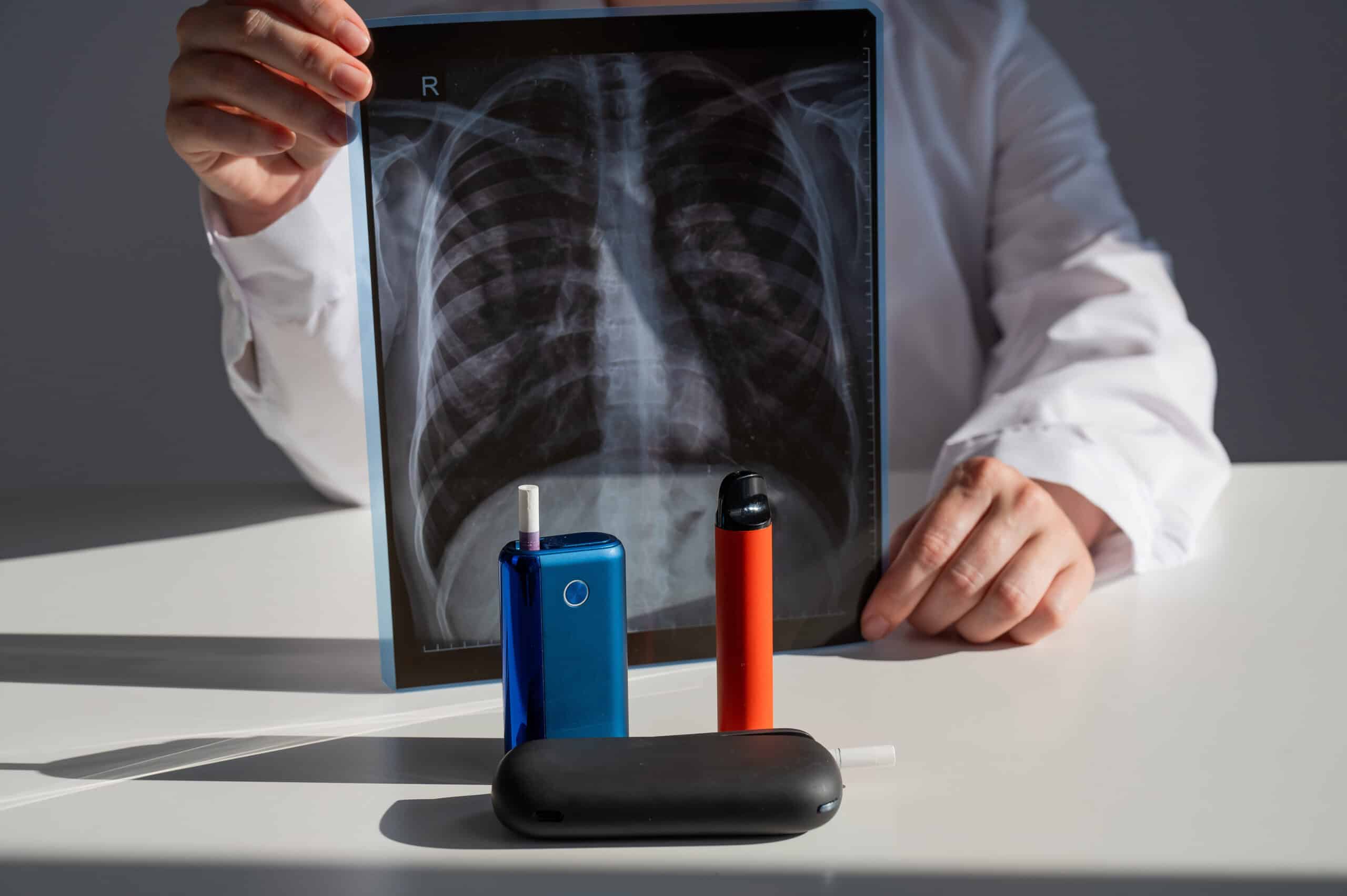 Le vapotage pourrait entraîner des signes précoces de maladies cardio-respiratoires chez les jeunes adultes